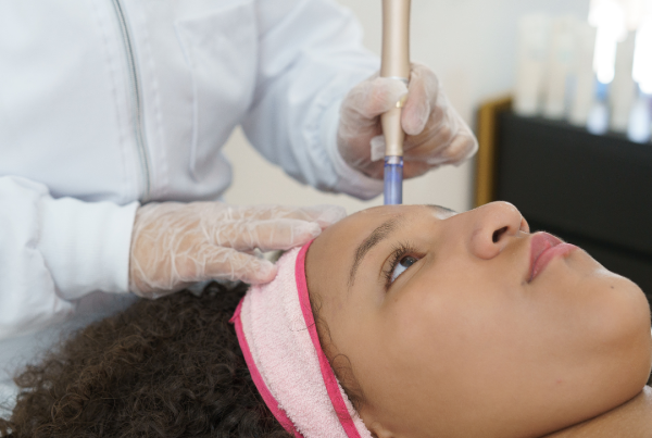 All About Microneedling